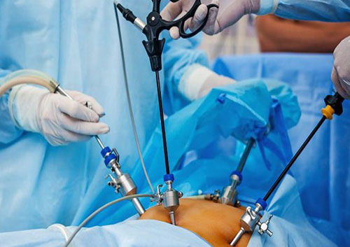 specialities - Laparoscopic surgery